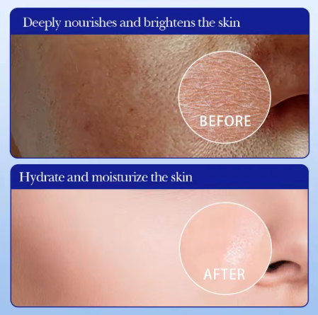 6 Mascarilla facial hidratante de alta hidratación SADOER