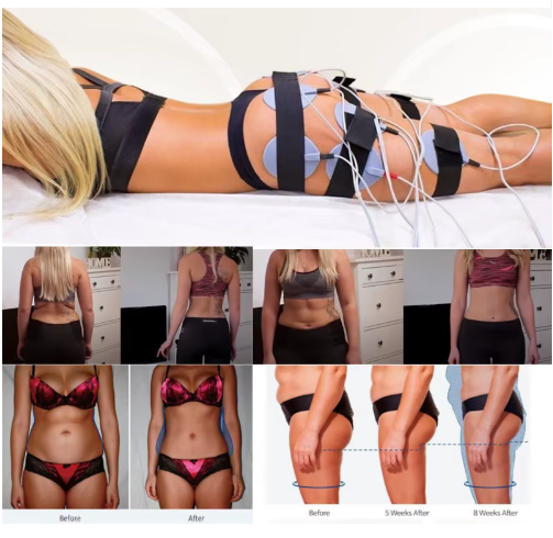 Gimnasia Pasiva con Electroestimulador Muscular de 10 Salidas